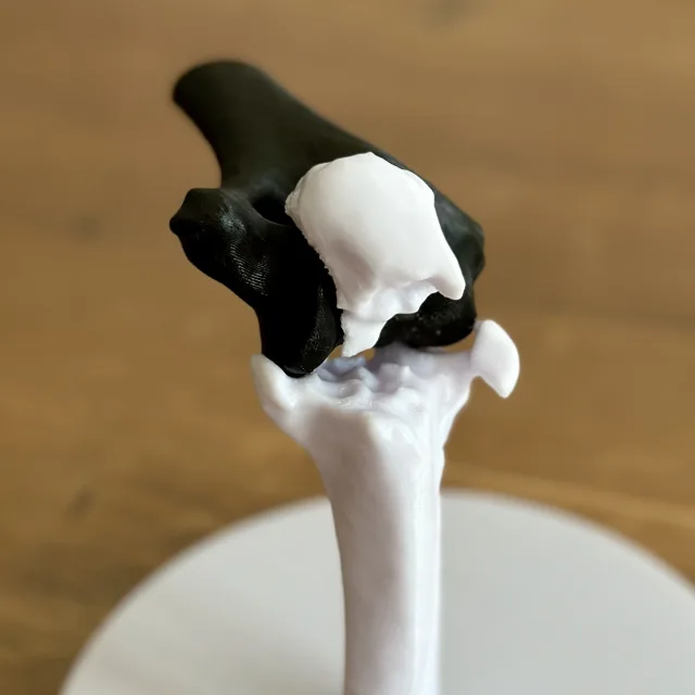 Olecanon Fraktur 3D Druckdatei