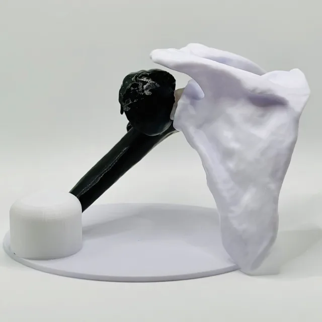 Oberarmkopf Fraktur 3D Modell