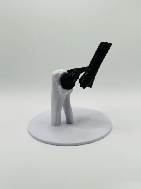 Oberarm Fraktur 3D Modell