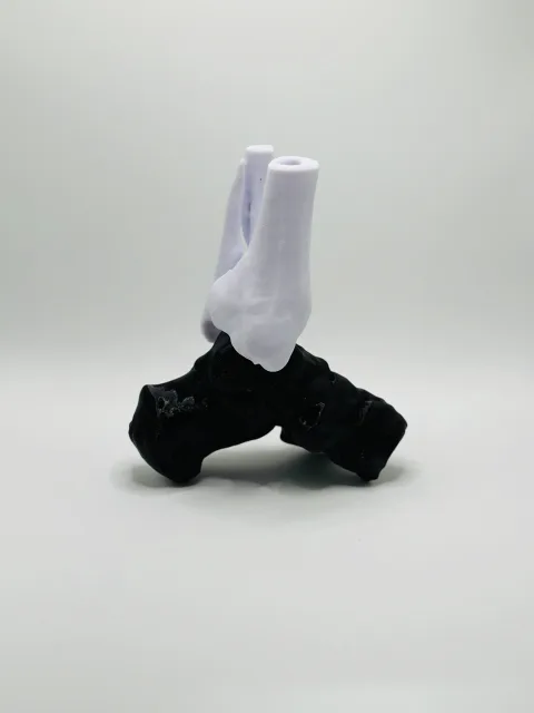 Weber C Fraktur 3D Modell