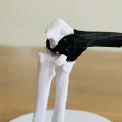 Olecanon Fraktur 3D Druckdatei
